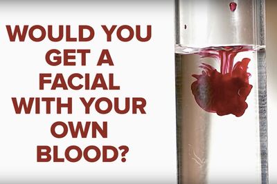 Video: Getting A Blood Facial