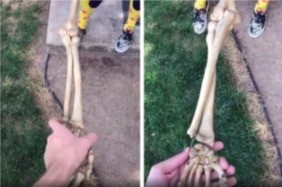 How Forearm Bones Actually Twist When You Use Your Arm