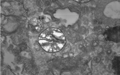 First Organism That Can Survive Without Oxygen Discovered By Scientists