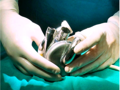 First Ever Titanium Heart Has Successfully Been Implanted Into A Human