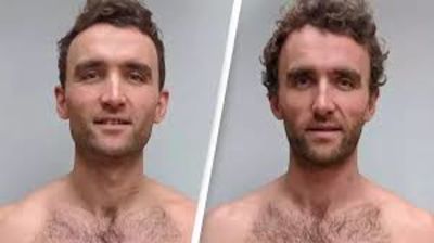 Identical Twins With Different Diets Conduct Study On The Different Body Changes